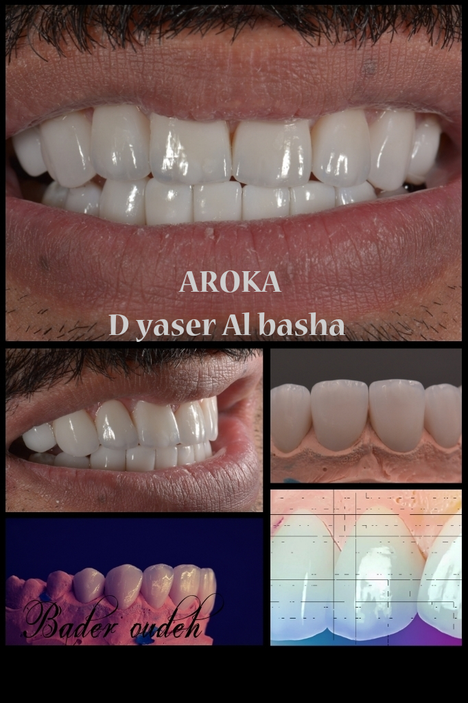مجمع اروكا الطبي للإسنان والجلديه في الرياض 0545359682 عيادة أسنان وجلدية بالرياض   P_1283b1aak8