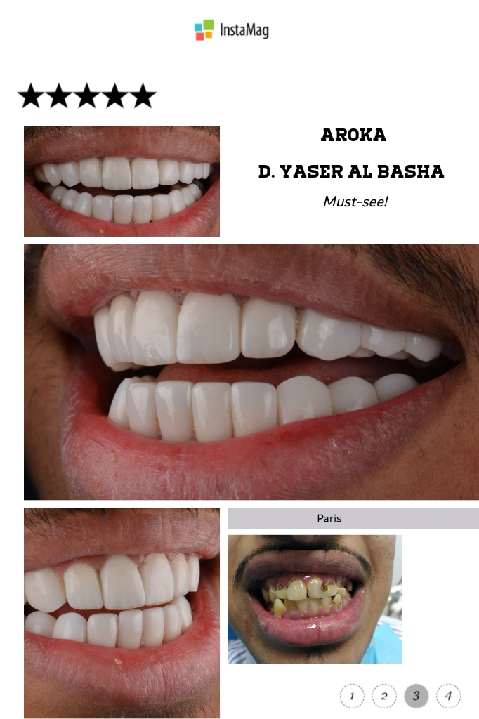 مجمع اروكا الطبي للإسنان والجلديه في الرياض 0545359682 تقويم اسنان بالرياض   P_1283qnezs2